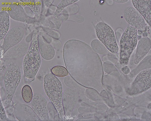 Volvariella gloiocephala - Cheilozystiden - 