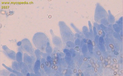 Volvariella murinella - Zystiden - 