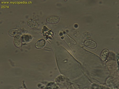 Melanoleuca friesii - Cheilozystiden mit Kristallschopf - 