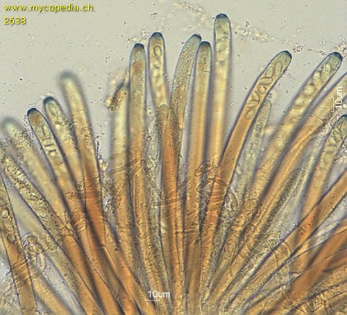 Operculum - Asci - 