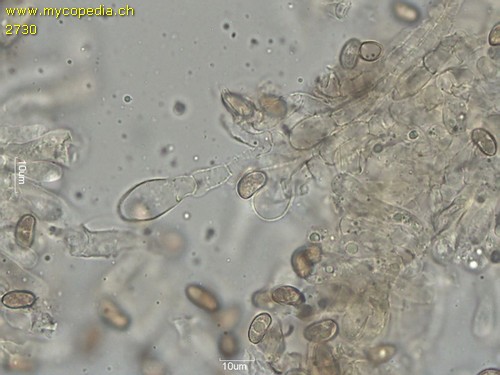 Inocybe dulcamara - Cheilozystiden - 
