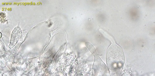 Volvariella murinella - Zystiden - 