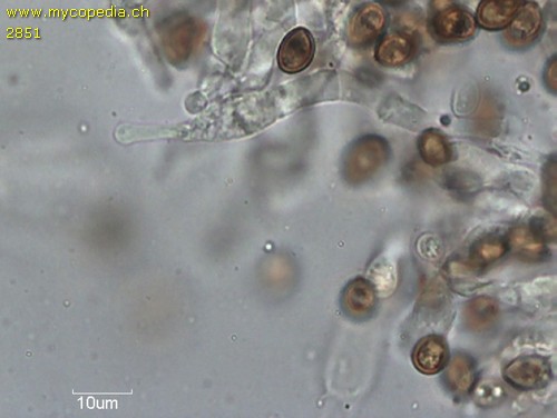 Agrocybe vervacti - Cheilozystiden - 