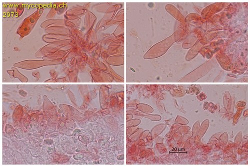 Gyroporus castaneus - Cheilozystiden - Kongorot  - 