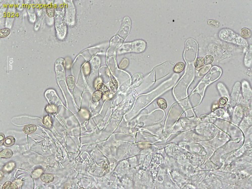 Tubaria furfuracea - Zystiden - 