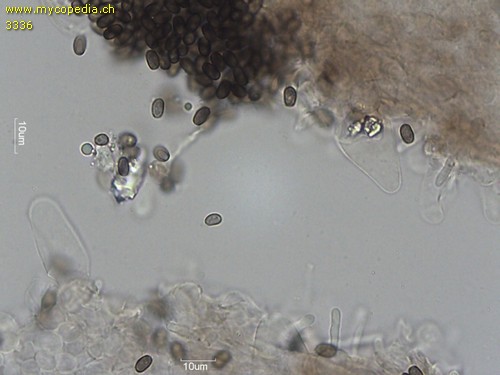 Psathyrella piluliformis - Cheilozystiden - 
