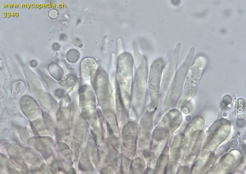 Mycena polygramma f. candida - Cheilozystiden - Wasser  - 