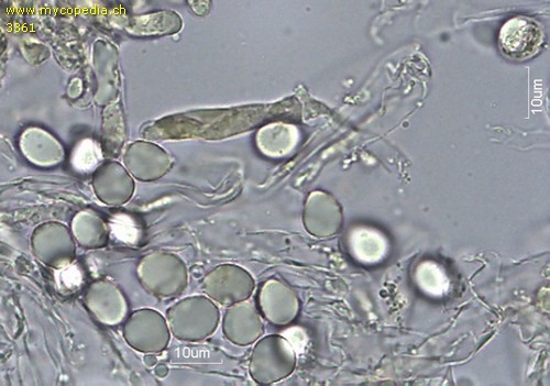 Clavulina rugosa - Sporen - Wasser  - 