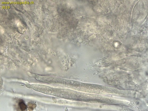 Peniophora incarnata - Gloeozystiden - 