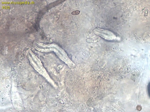 Peniophora incarnata - Lamprozystiden - 