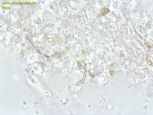 Peniophorella pubera - Basidien - 