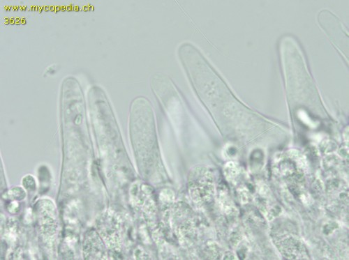 Hydropodia subalpina - Zystiden - 