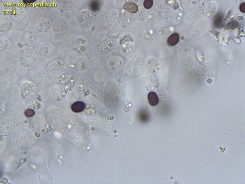 Psathyrella leucotephra - Cheilozystiden - 