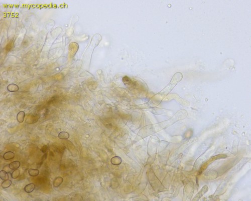 Simocybe centunculus - Cheilozystiden - 