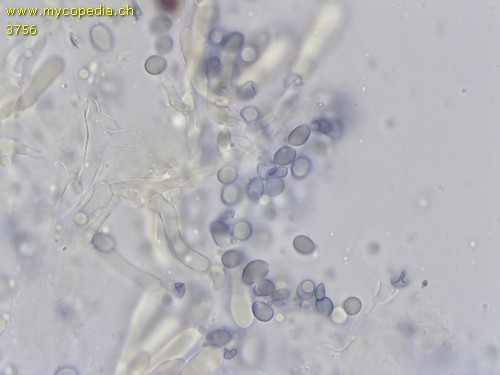 Pseudoporpoloma pes-caprae - Sporen - Melzers  - 