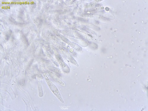 Crinipellis scabella - Cheilozystiden - 
