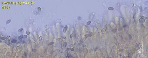 Baeospora myosura - Sporen - 