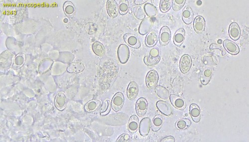 Melanoleuca cognata - Sporen - Wasser  - 