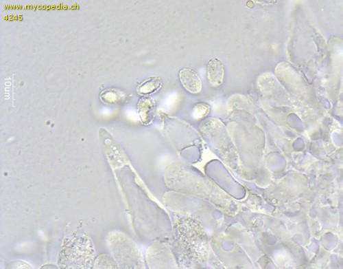 Melanoleuca cognata - Cheilozystiden - 