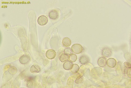Crepidotus applanatus - Cheilozystiden - 