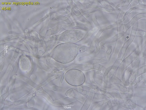 Singerocybe phaeophthalma - HDS mit blasigen Zellen - 