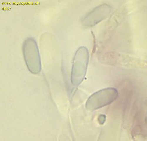 Roridomyces roridus - Sporen - 