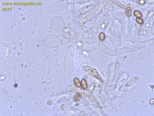 Pholiota carbonaria - Cheilozystiden - 