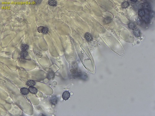 Russula exalbicans - Cheilozystiden - 