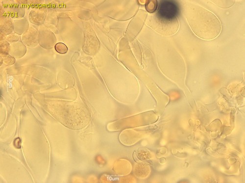 Leucocoprinus cepistipes - Cheilozystiden - 