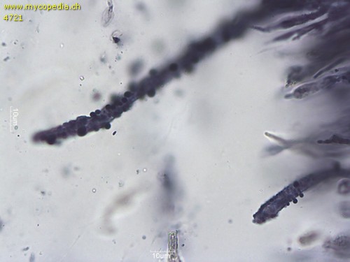 Russula turci - Primoridalhyphen inkrustiert - 