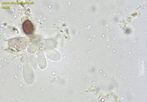 Cortinarius duracinus var. raphanicus - Marginalzellen - 