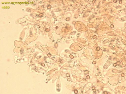 Mallocybe fuscomarginata - Cheilozystiden - 