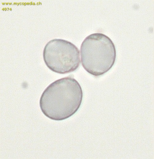 Amyloiditt - Sporen - 