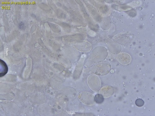 Amanita phalloides var. alba - Marginalzellen - 