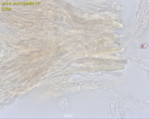 Basidioradulum radula - Lamprozystiden - 