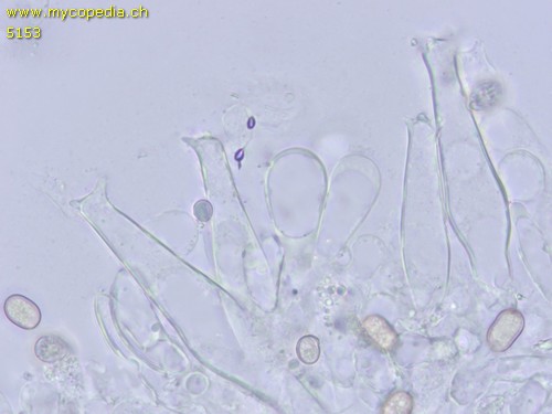 Pluteus salicinus - Hakenzystide/n - 