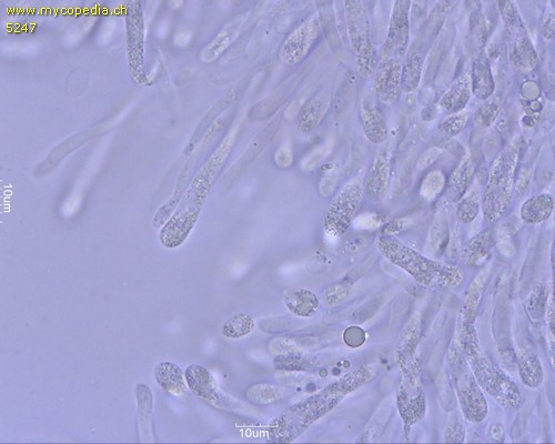 Cuphophyllus virgineus var. virgineus - Marginalzellen - 