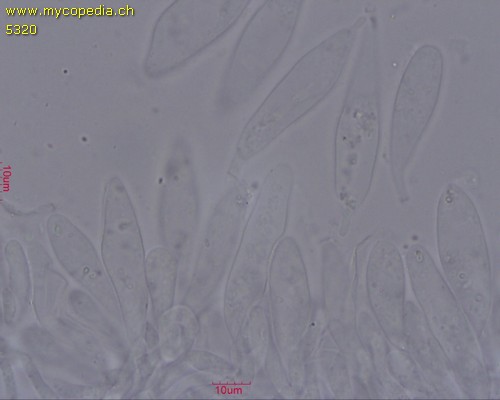 Pluteus thomsonii - Cheilozystiden - 