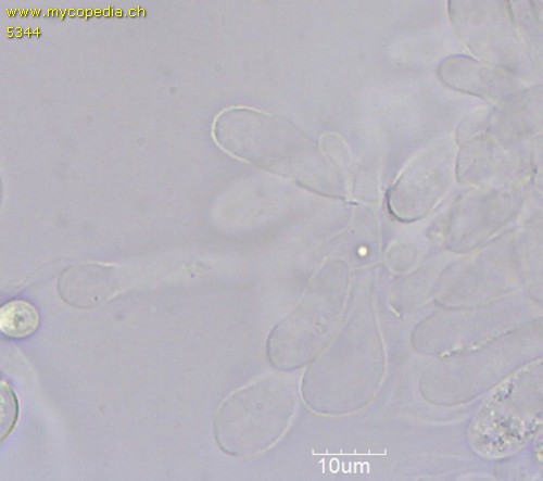 Macrolepiota mastoidea - Cheilozystiden - 