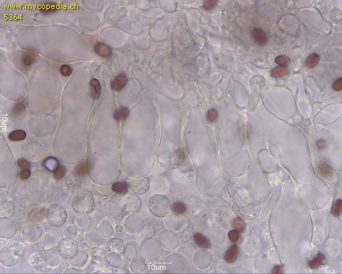 Psathyrella spadiceogrisea - Pleurozystiden - 