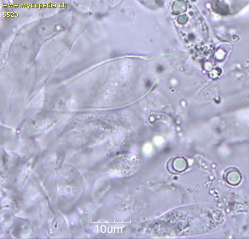 Melanoleuca friesii - Cheilozystiden - 