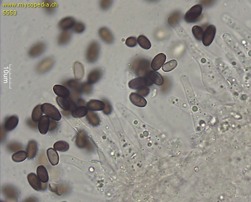 Psathyrella multipedata - Cheilozystiden - 