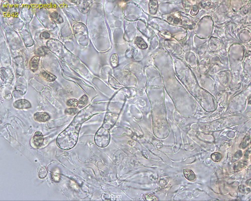 Tubaria furfuracea - Cheilozystiden - 