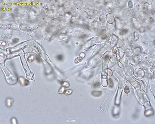 Tubaria furfuracea - Cheilozystiden - 