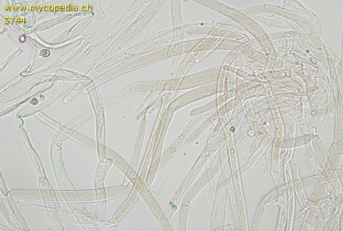 Pluteus ephebeus - Hyphen braun inkrustiert - 