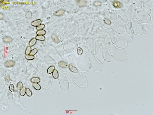 Cyclocybe aegerita - Cheilozystiden - 