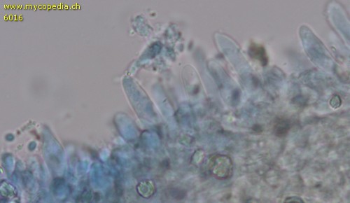 Baeospora myosura - Cheilozystiden - 