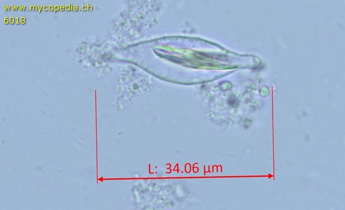 Baeospora myosura - Cheilozystiden - 