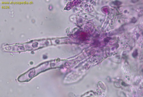Russula lilacea - Primoridalhyphen inkrustiert - 