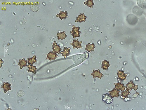 Inocybe asterospora - Zystiden - 